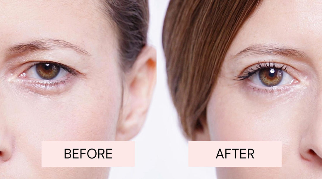 The Ultimate Guide to Eyelids Lifting Strips: Hooded Eyes, Mono Eyelids, and Blepharoplasty